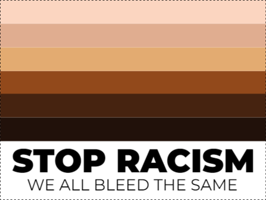 24x18
